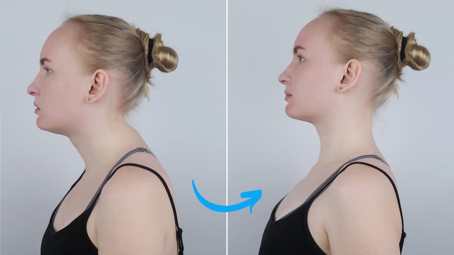 Thousands Are Beating That Nasty Neck Hump Thanks to A